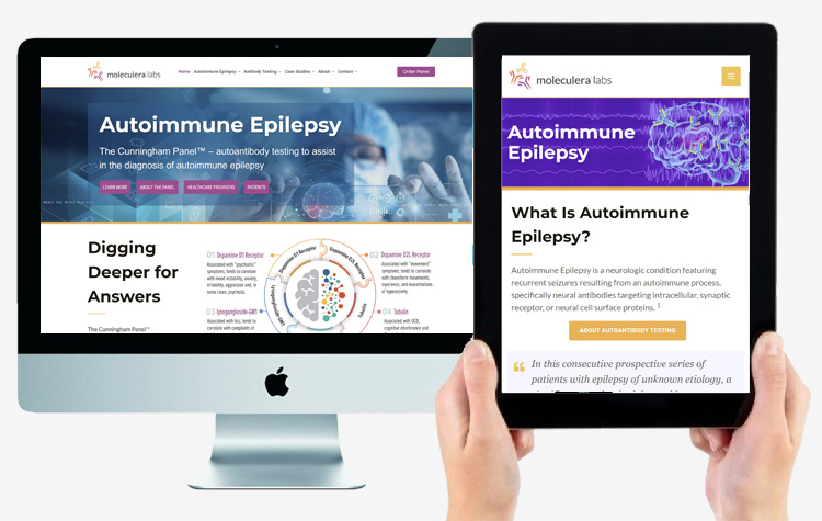 Autoimmune Epilepsy Website